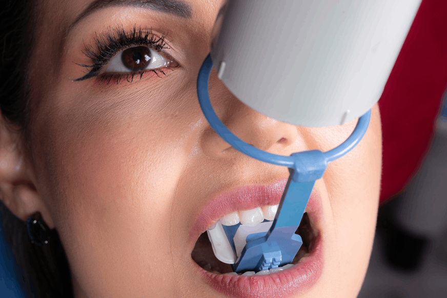 Position Indicating Device Radiograph Radiographic Positioner Cone Indicator for Anterior Teeth – Indusbello